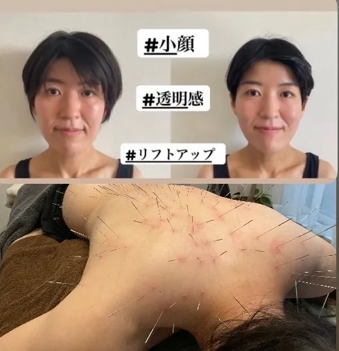 鍼処NAKAGAWA 慢性不調・薄毛 邪気抜き 院詳細 | 明石・東播磨・北播磨