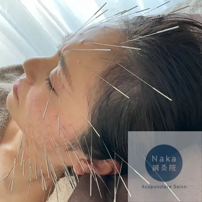 Naka鍼灸院