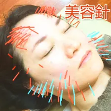 なごみ鍼灸接骨院 御器所院