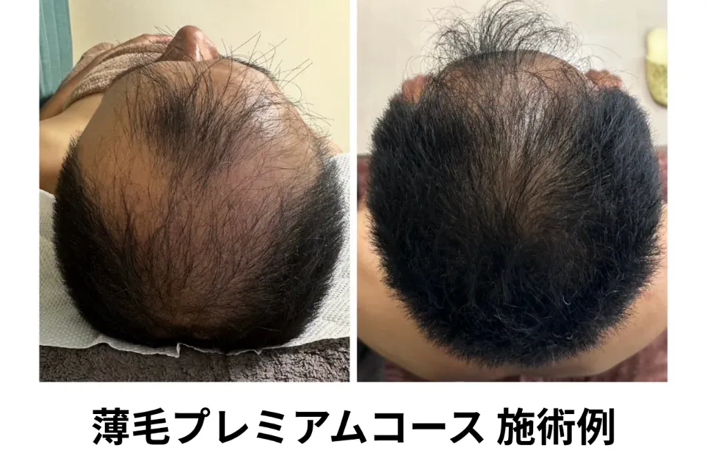 RISA鍼灸院