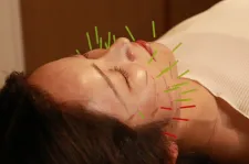 Alegria 美容鍼・小顔矯正・骨盤矯正