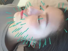 鍼灸salon bloom