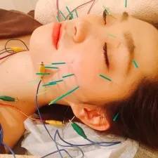 神門産後美容鍼サロン 甲子園