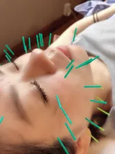 美容鍼灸サロンLILE/すみれ鍼灸整骨院