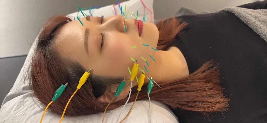 HARIBEE大阪本町 院詳細 | 本町・船場の鍼灸院・美容鍼サロン