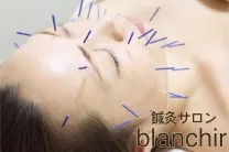 鍼灸サロンblanchir