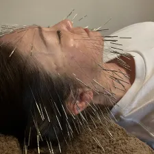アディオ鍼灸カイロプラクティック