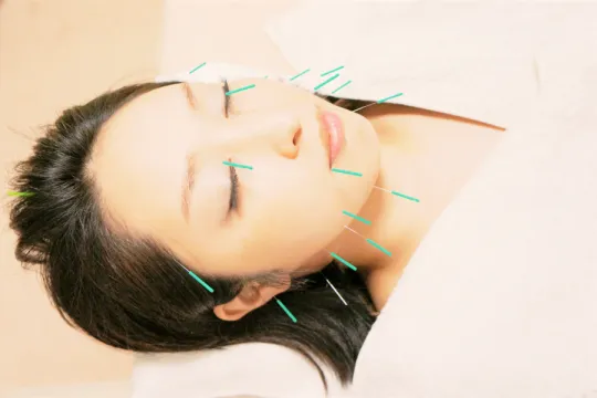 美容鍼灸 Harico 院詳細 | 両国・錦糸町・小岩の鍼灸院・美容鍼