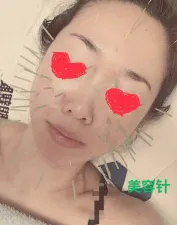 ひかり鍼灸整骨院