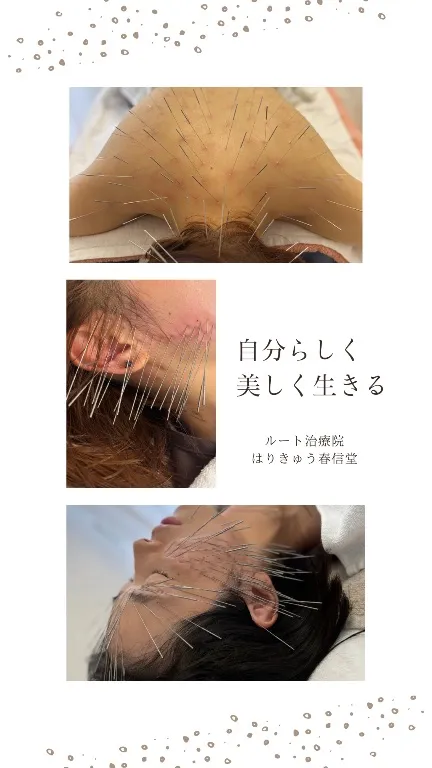 はりきゅう春信堂 目白院
