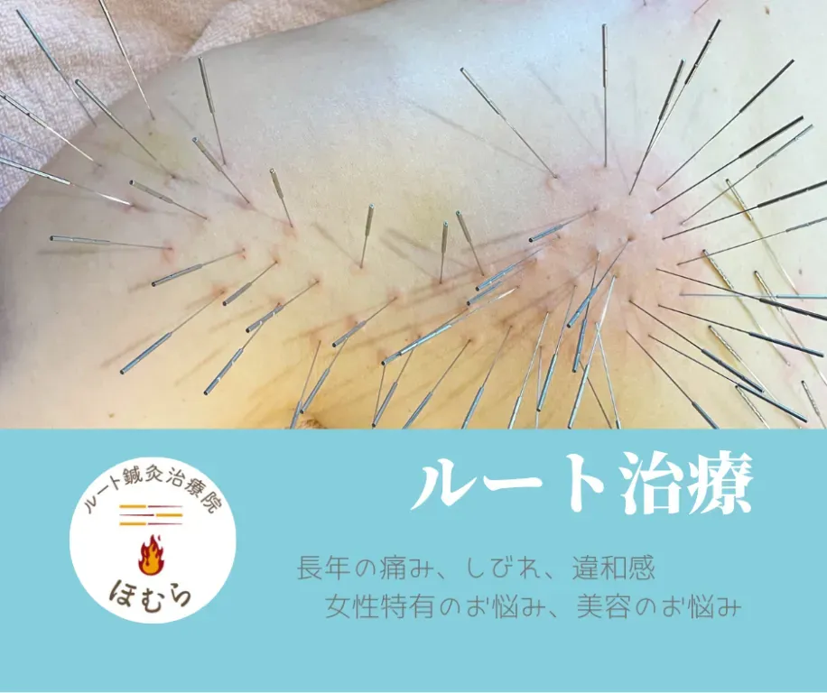 ルート鍼灸治療院ほむら