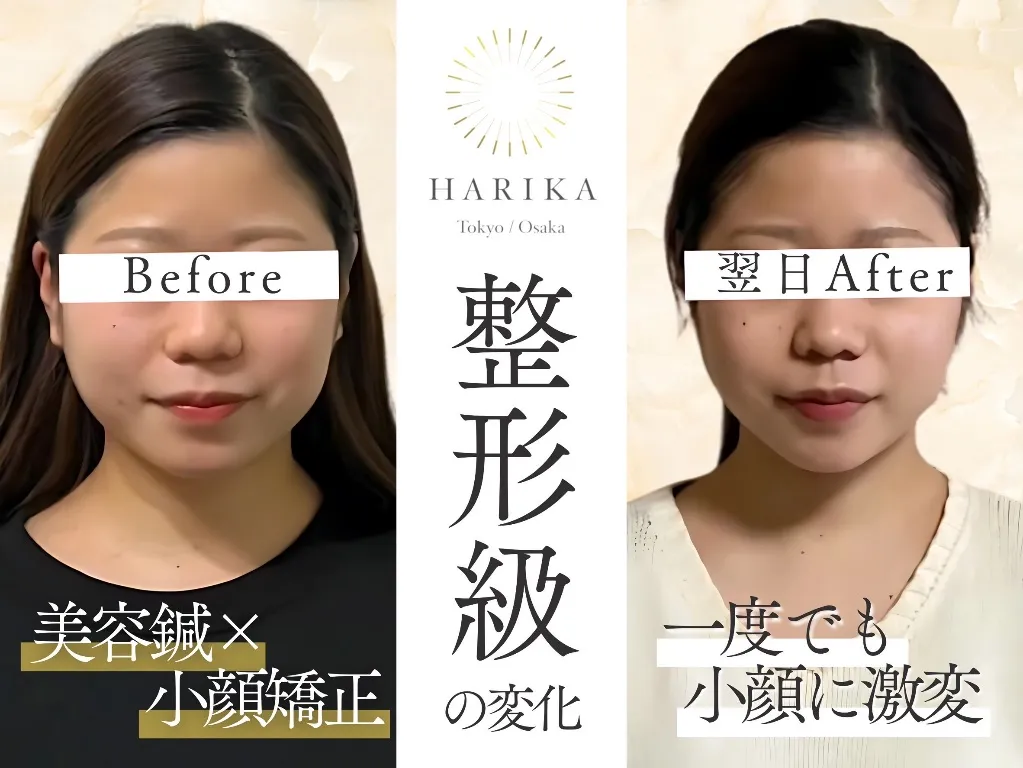 小顔美容鍼灸院 HARIKA 大阪 心斎橋店
