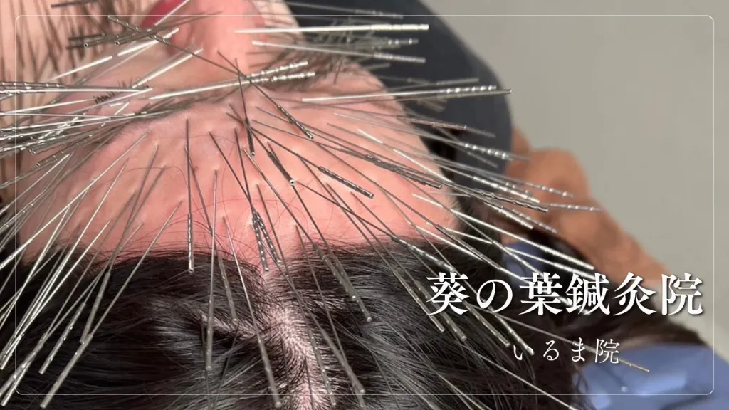 葵の葉鍼灸院 いるま院