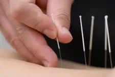 女性専用 侯鍼灸院