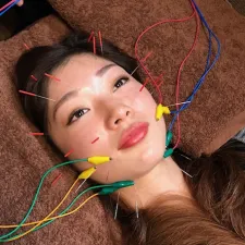 かがやき鍼灸整骨院
