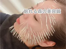 美容鍼整体マッサージ治療院 プレシャスワン越谷店 女性の悩み専門 肩こり 国家資格有