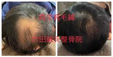 穴田鍼灸整骨院