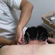 直鍼堂はり治療院
