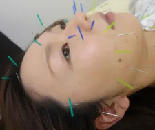 美療鍼灸整骨院