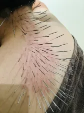 プロアスリート鍼灸整骨院
