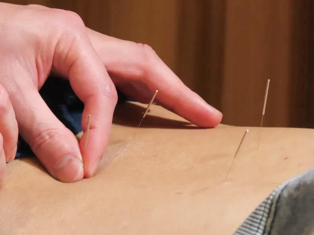 長崎きざし鍼灸整骨院 宝町店のこだわりポイント