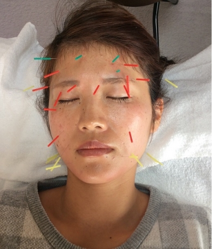 アピール写真