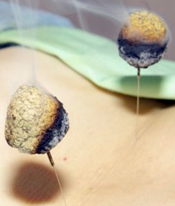 小林鍼灸院・接骨院のこだわりポイント