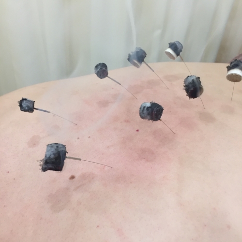 鍼灸整骨カラダステーションのこだわりポイント