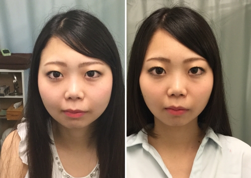 源整体院 はりきゅう治療院のこだわりポイント