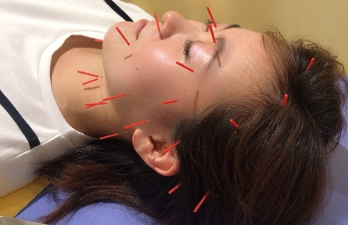 川口統合整骨院・鍼灸院のこだわりポイント