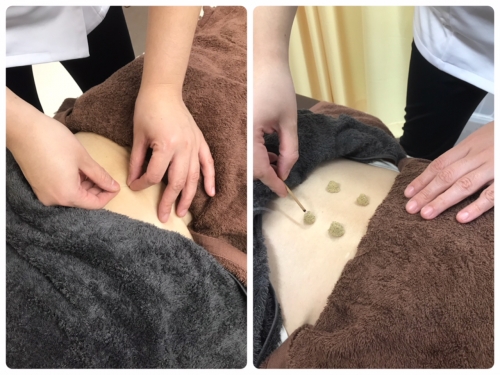 わちゅう堂鍼灸治療院のこだわりポイント