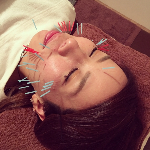 アピール写真