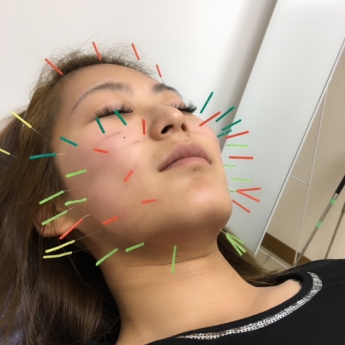 アピール写真