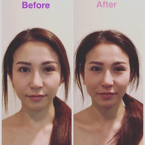 はり灸治療院 リメイクのこだわりポイント