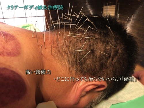クリアーボディ鍼灸治療院のこだわりポイント