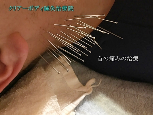 クリアーボディ鍼灸治療院のこだわりポイント