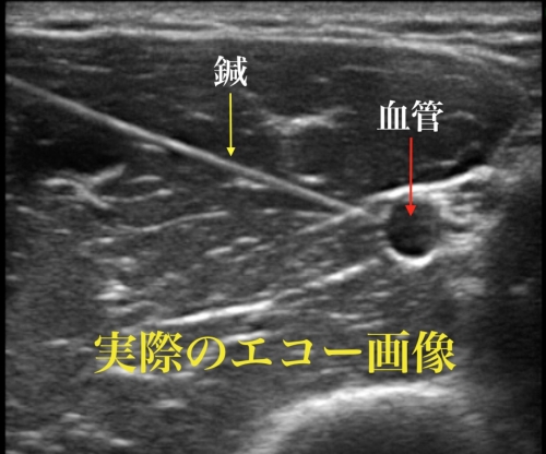 鍼灸院まごのて堂 あきる野院のこだわりポイント