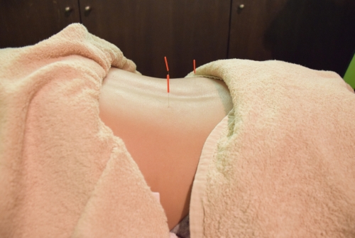 マハロ港南はりきゅう院のこだわりポイント