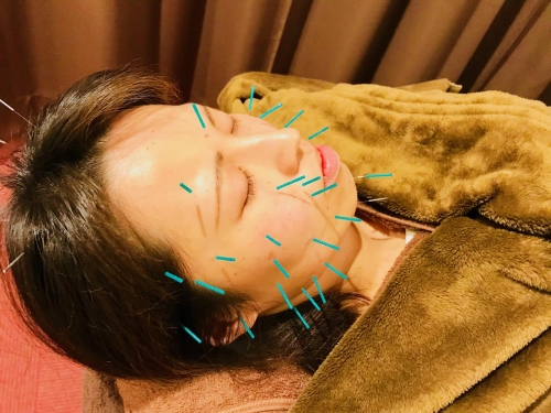 アピール写真