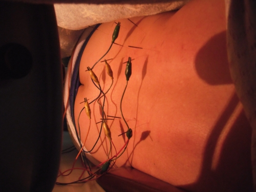 太成鍼灸院のこだわりポイント