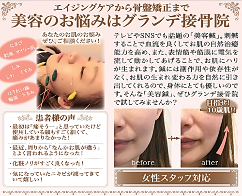 アピール写真