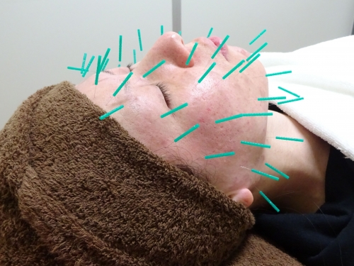 アピール写真