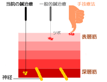 にしかわ鍼灸整骨院のこだわりポイント