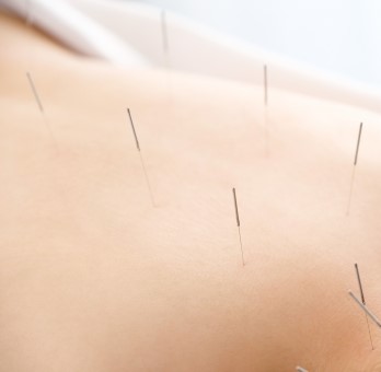 出張専門こしがや鍼灸治療所のこだわりポイント