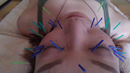 伊藤鍼灸院 PeaceHealingのこだわりポイント