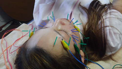 伊藤鍼灸院 PeaceHealingのこだわりポイント