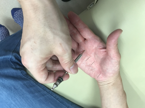 ほった鍼灸治療院のこだわりポイント