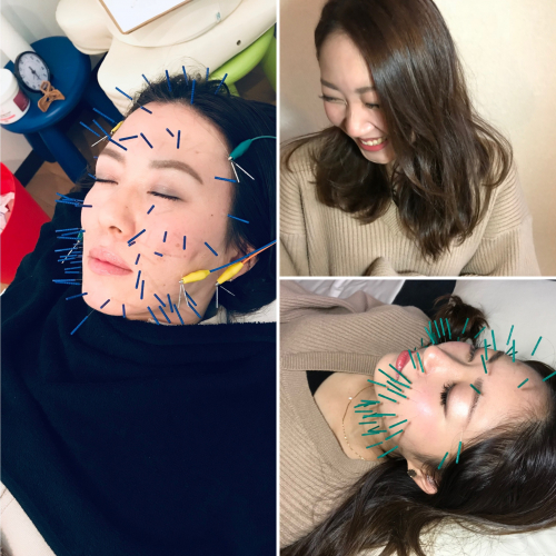 アピール写真