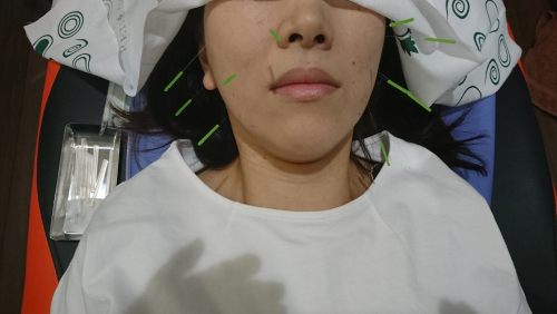 アピール写真