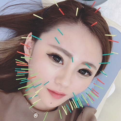 アピール写真